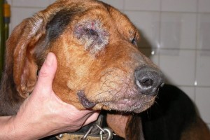 leishmaniasis